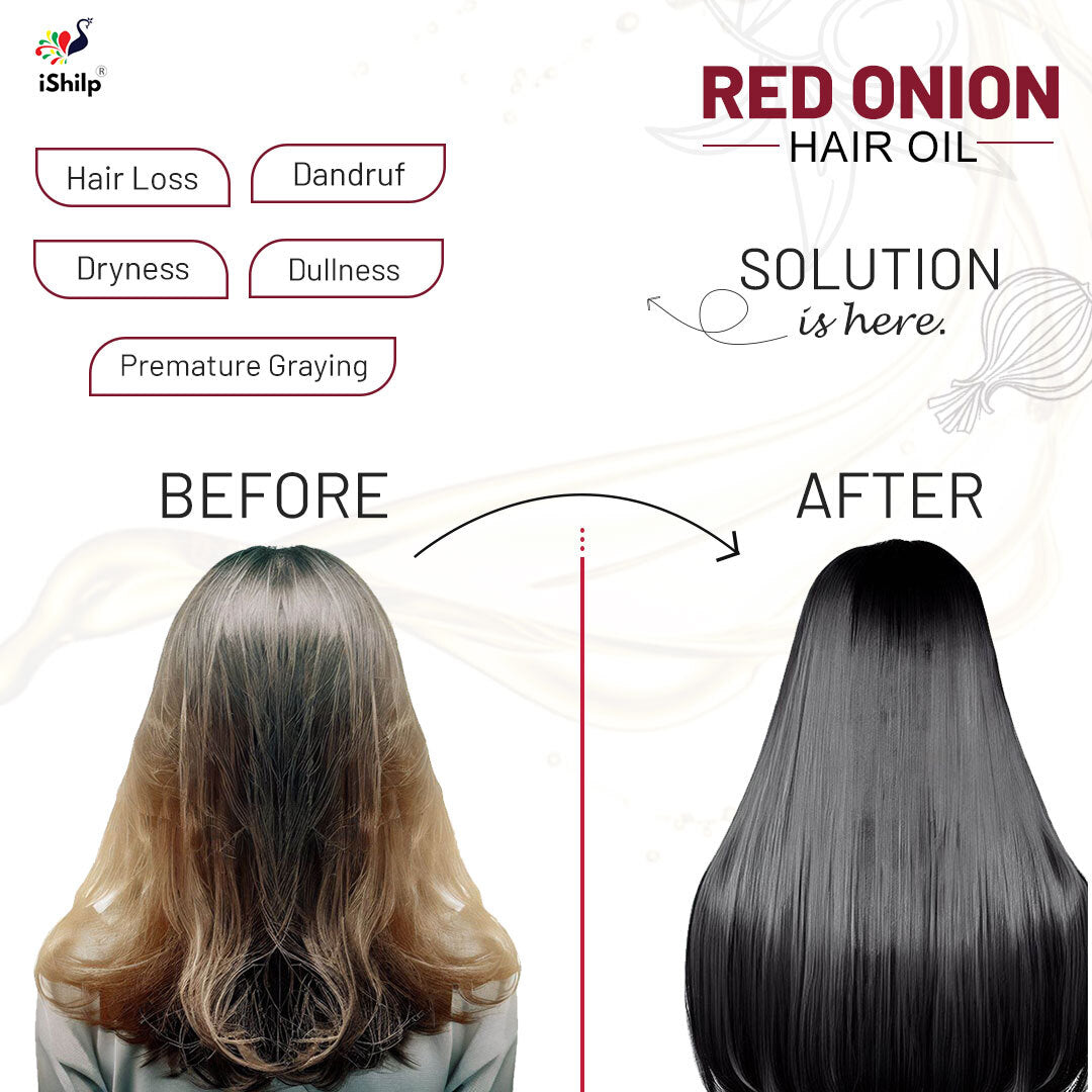 Red Onion Hair Oil